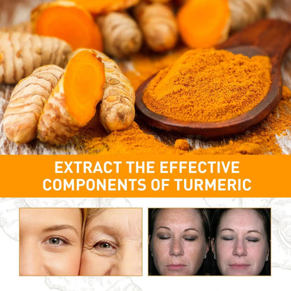 10PCS 10ml Turmeric Essential Oil Organic Tumeric Oil For Dark Spots 100 Pure And Natural Therapeutic Grade Essential Oil Tumeri