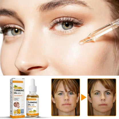 Turmeric Essential Oil Facial Repair Serum Anti-Wrinkle Lifting Firming Face Moisturiz Brighten Essence for Dark Spot Corrector