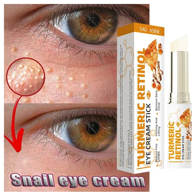 Fat Granules Removal Eyestick Anti-Puffiness Firming Cream Anti Inflammatory Fade Fine Line Repair Skin Barrier Skin Care New