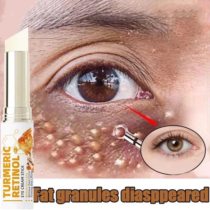 Fat Granules Removal Eyestick Anti-Puffiness Firming Cream Anti Inflammatory Fade Fine Line Repair Skin Barrier Skin Care New