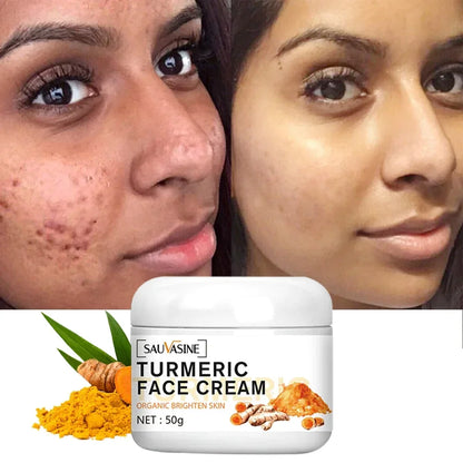 Turmeric Face Cream Acne Treatment Dark Spots Removal Moisturizing Brightening Whitening Cream for Dark Skin Care Beauty Health