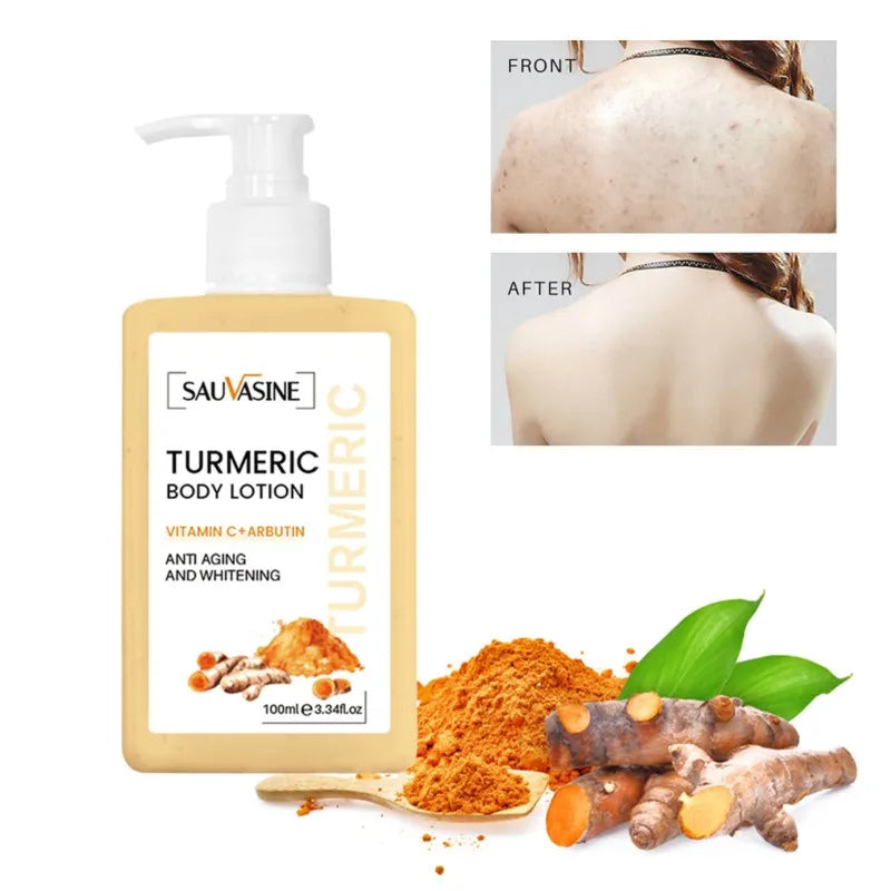 Whitening Turmeric Cream 100ml - Skin Lightening | Grace Galeria