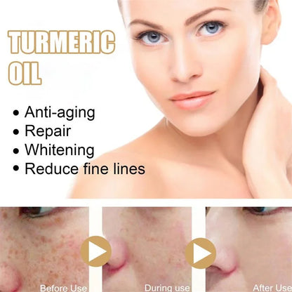 Freckle Remove Turmeric Serum Curcumin Oil Face Whitening Brighten Moisturizing Fade Dark Spot Removal Melaninskin Turmeric Oil