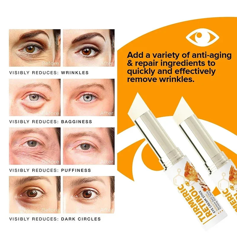 Fat Granules Removal Eyestick Anti-Puffiness Firming Cream Anti Inflammatory Fade Fine Line Repair Skin Barrier Skin Care New