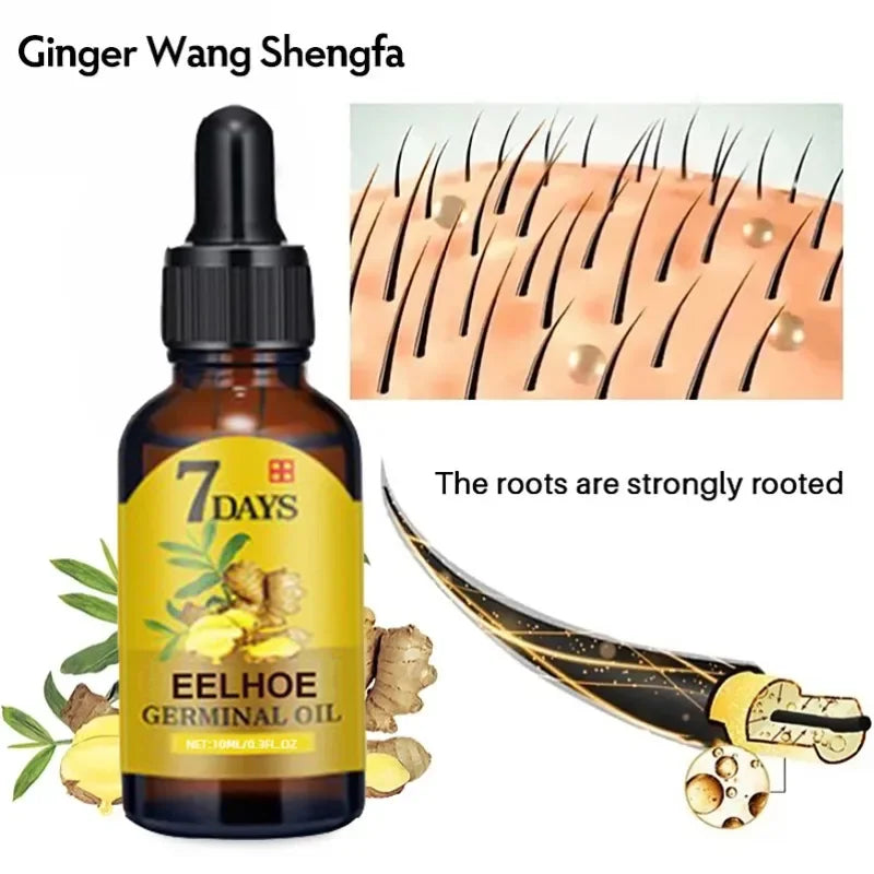 Fast Hair Growth Ginger Growth Hair Oil Treatment Anti Hair Loss Men Women Scalp Treatment Serum Products Beauty Health